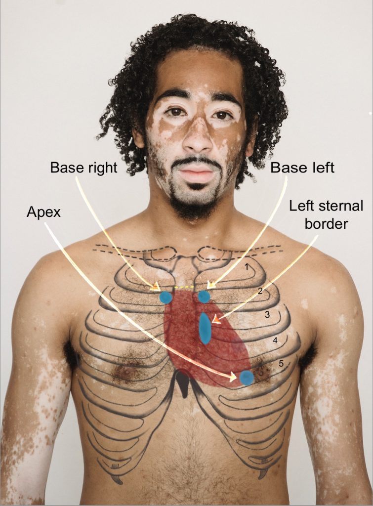 A man's naked chest with the heart and ribs drawn on top of the area.