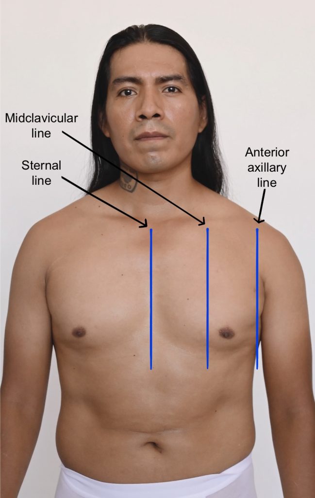 Anterior reference lines marked on a person's chest.