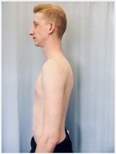 Lateral (transverse) perspective of an individuals chest/thorax.