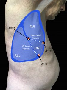 A man's right lateral chest with lungs, including lobes and landmarks drawn onto image and noted.