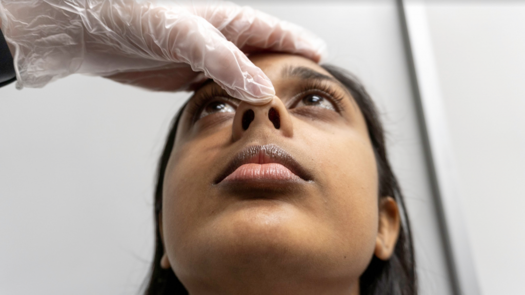 Healthcare provider has gloved thumb on clients nose and fingers on forehead to look into the nasal cavity. Client's head is tilted slightly back.