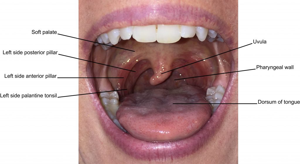 Inside side of an individual's mouth.