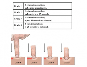 Inspection And Palpation Of Feet And Legs Introduction To Health