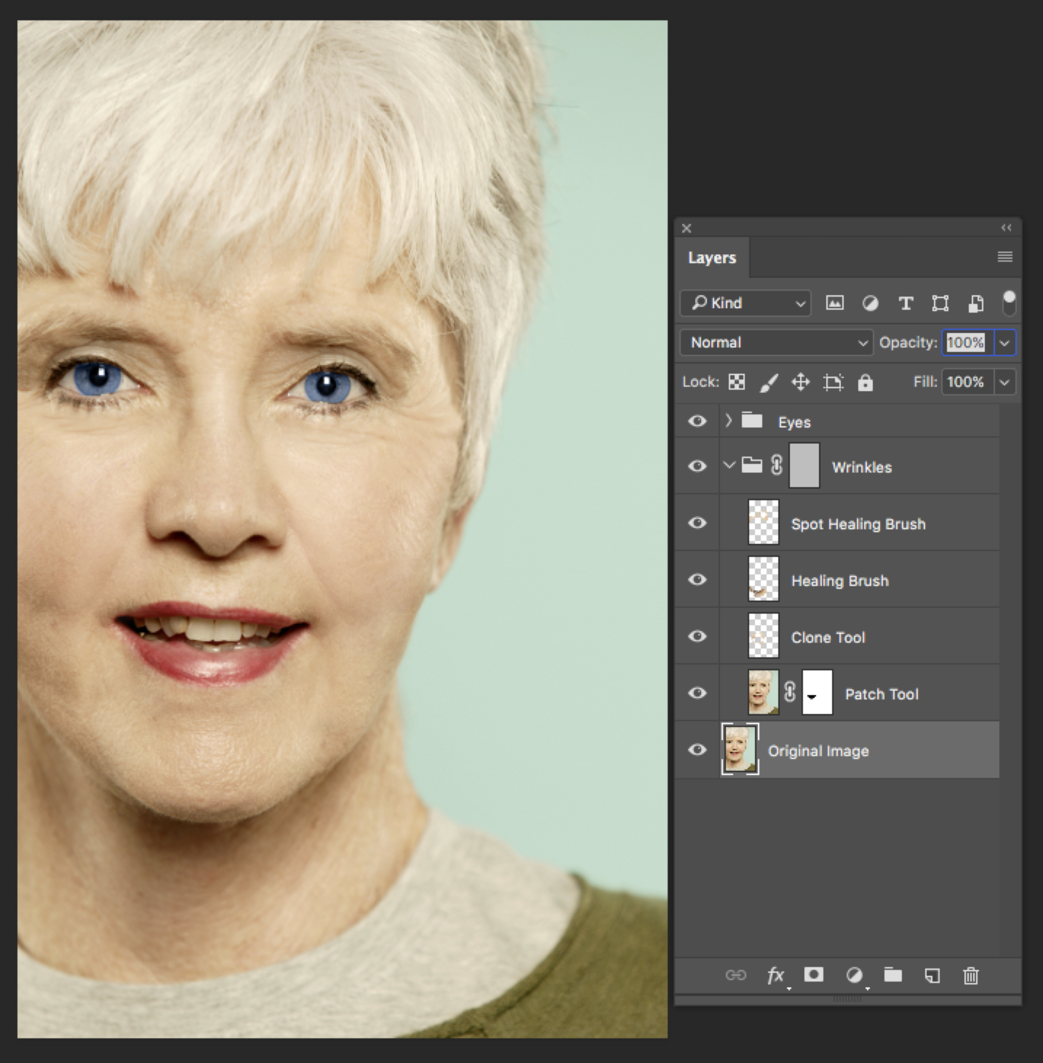 Photoshop screen capture demonstrating the layers order and fix of the scar in the right-side of the mouth