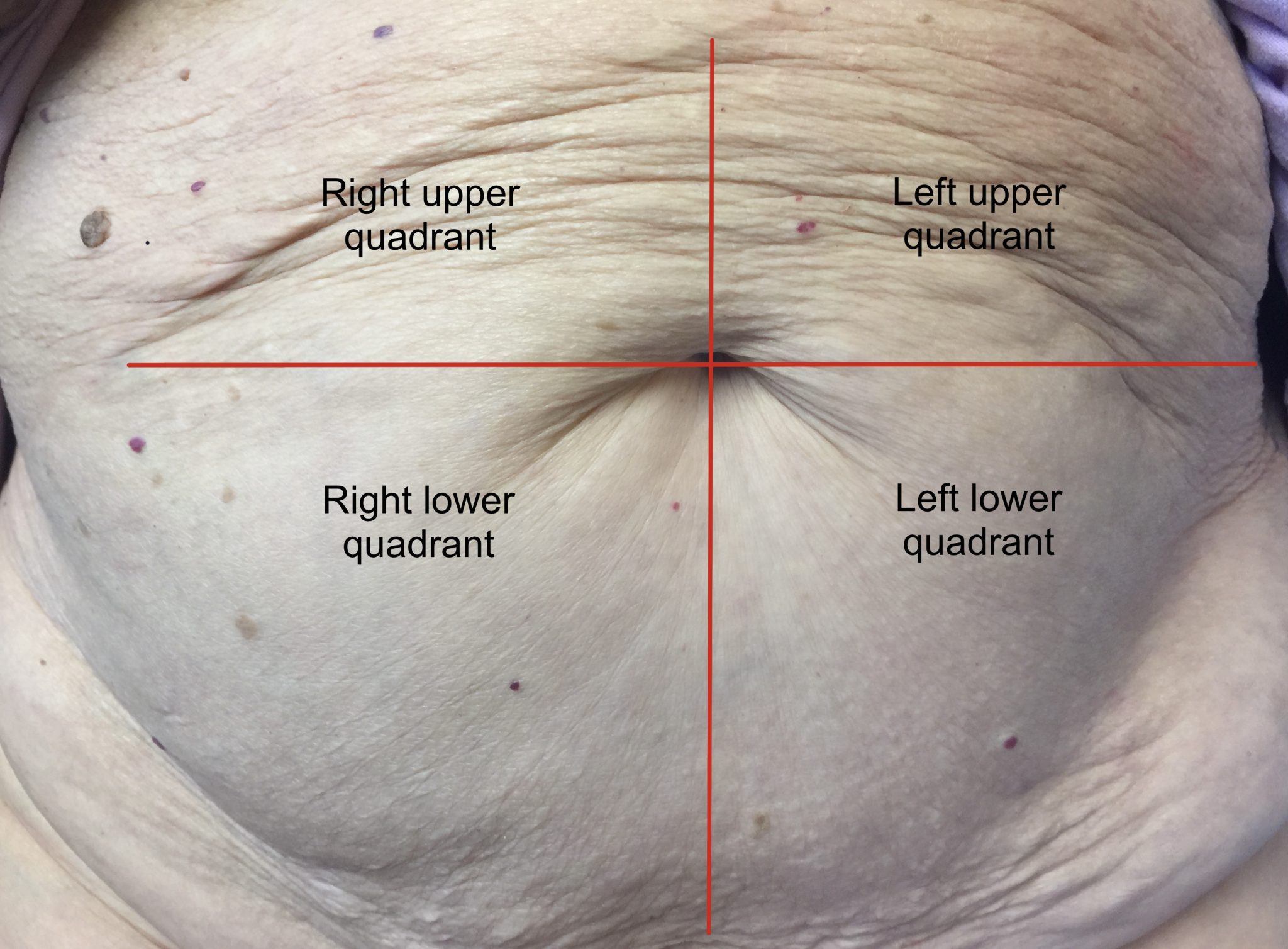 Abdomen Inspection Introduction To Health Assessment For The Nursing Professional