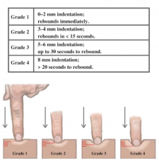 Skin: Palpation – Introduction to Health Assessment for the Nursing ...