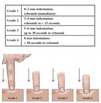 Skin: Palpation – Introduction to Health Assessment for the Nursing ...