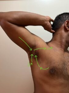 Lymph node drainage pattern areas identified with green arrows in the axillary area.