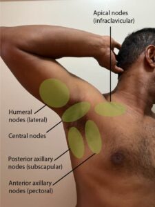 Five lymph node areas identified in the axillary.