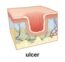 Skin: Inspection – Introduction to Health Assessment for the Nursing ...